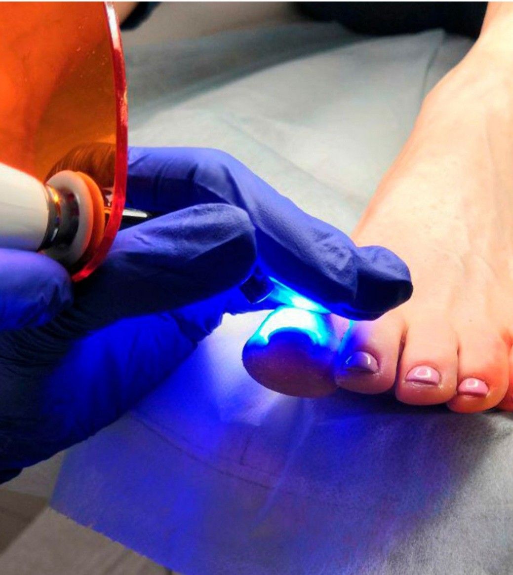 Pedicure Clínico en Medellín - Quiropedia La Francia
