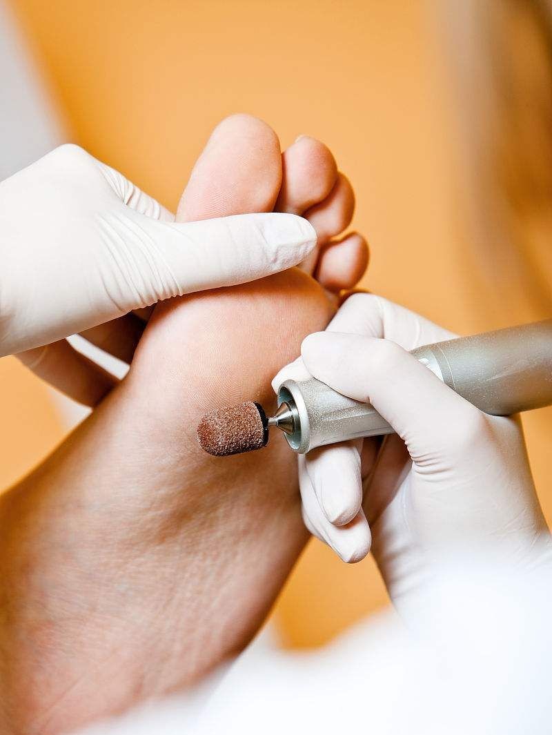 Tratamiento Pie Diabético en Medellín - Quiropedia La Francia